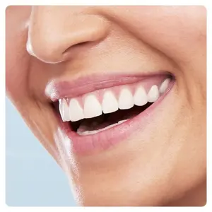 oral-b-pulsonic-slim-luxe-4100-adult-sonic-toothbrush-rose-g-32569-wlononwcrojgz.webp