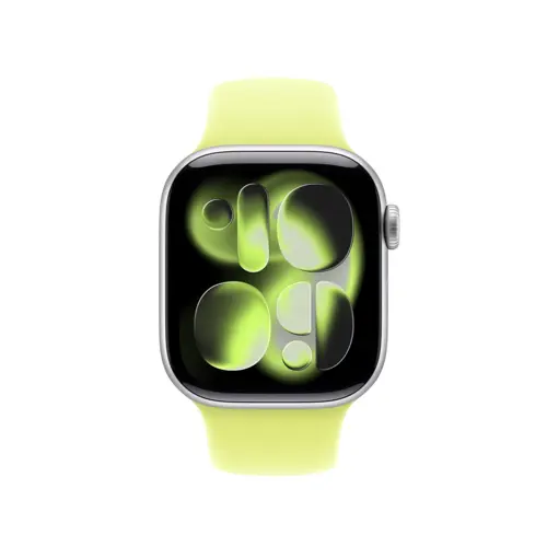 apple-mfgc4zma-smart-wearable-accessories-band-yellow-fluoro-1863-wlononwcrokwx.webp